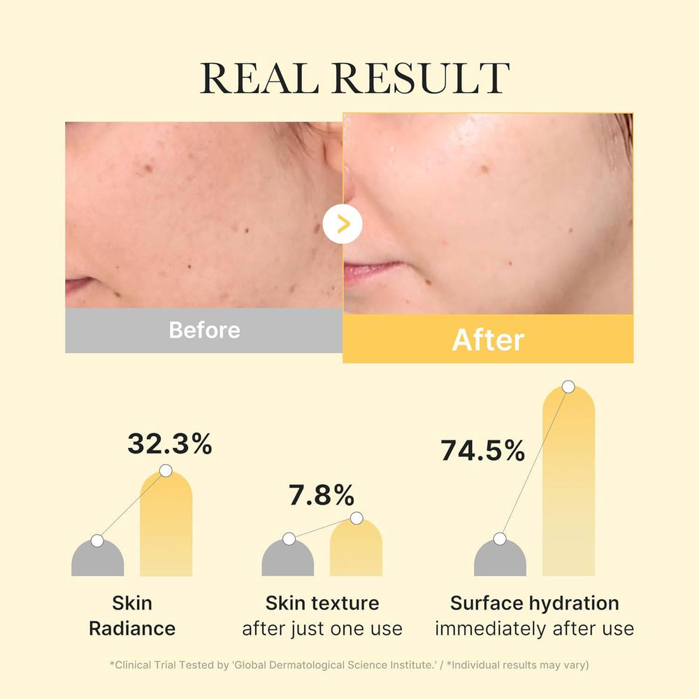 Medicube - Kojic Acid Turmeric Brightening Gel Mask - 28g